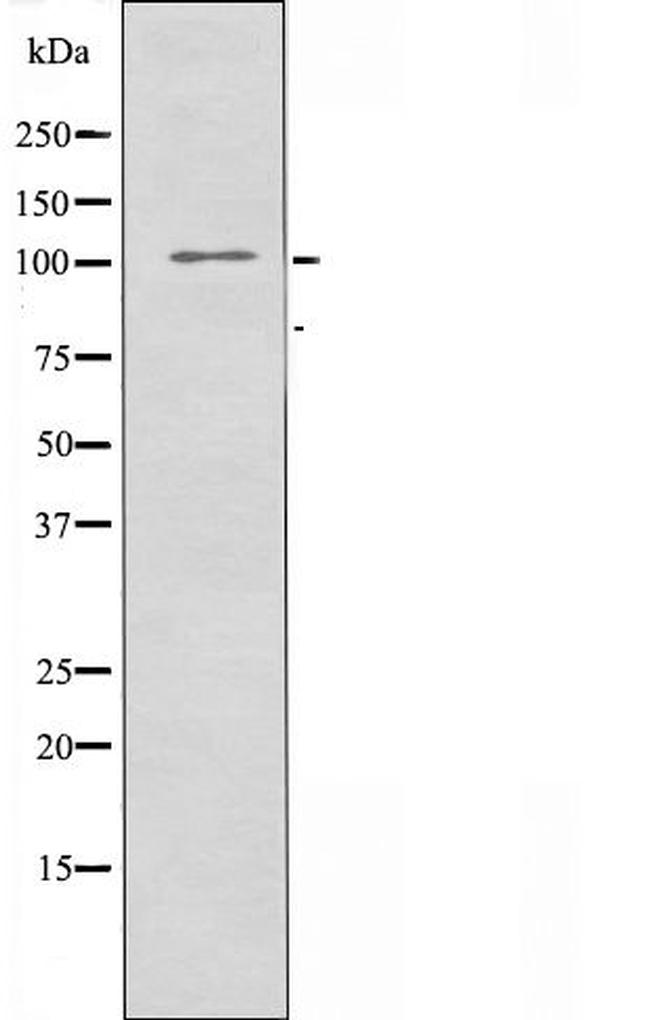 GPR110 Antibody in Western Blot (WB)
