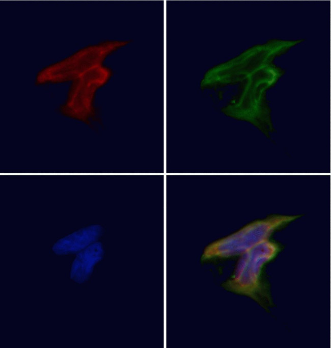 GPR119 Antibody in Immunocytochemistry (ICC/IF)