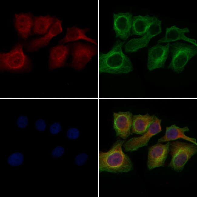 GPR150 Antibody in Immunocytochemistry (ICC/IF)