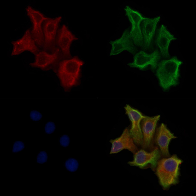 GPR160 Antibody in Immunocytochemistry (ICC/IF)