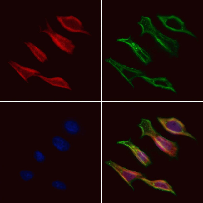 CCZ1B Antibody in Immunocytochemistry (ICC/IF)