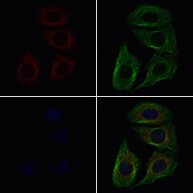 CSRL1 Antibody in Immunocytochemistry (ICC/IF)