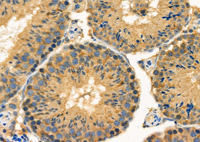 EDG4 Antibody in Immunohistochemistry (Paraffin) (IHC (P))