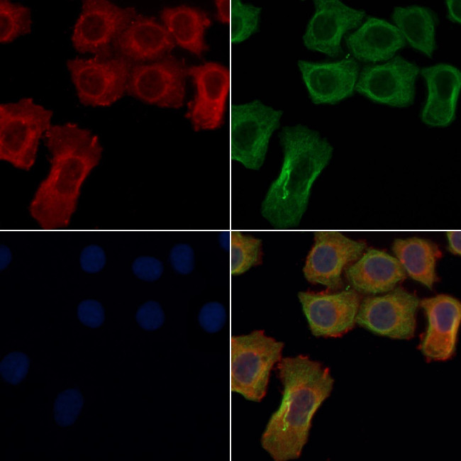 GPR114 Antibody in Immunocytochemistry (ICC/IF)