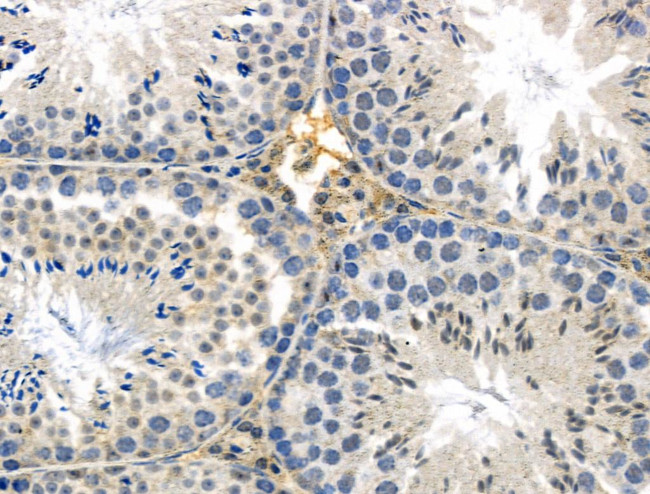 GPR135 Antibody in Immunohistochemistry (Paraffin) (IHC (P))