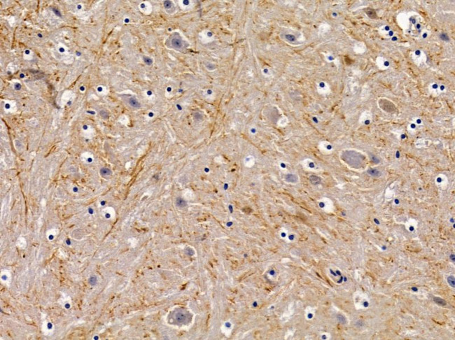 GPR156 Antibody in Immunohistochemistry (Paraffin) (IHC (P))