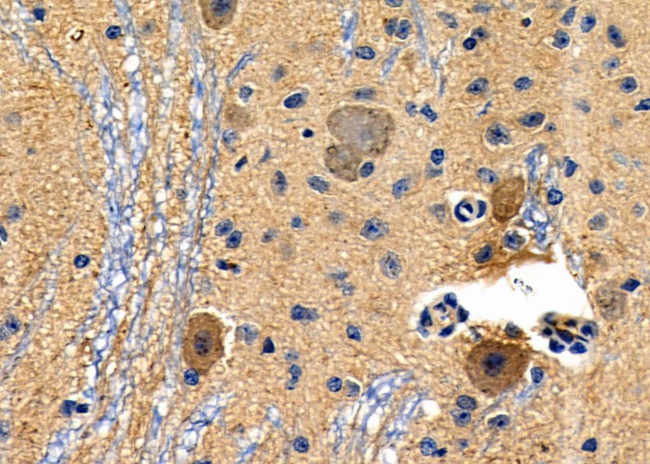 GPR34 Antibody in Immunohistochemistry (Paraffin) (IHC (P))