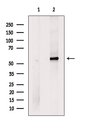 MC5R Antibody in Western Blot (WB)