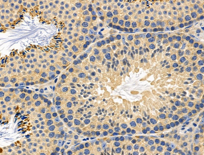 mPR alpha Antibody in Immunohistochemistry (Paraffin) (IHC (P))