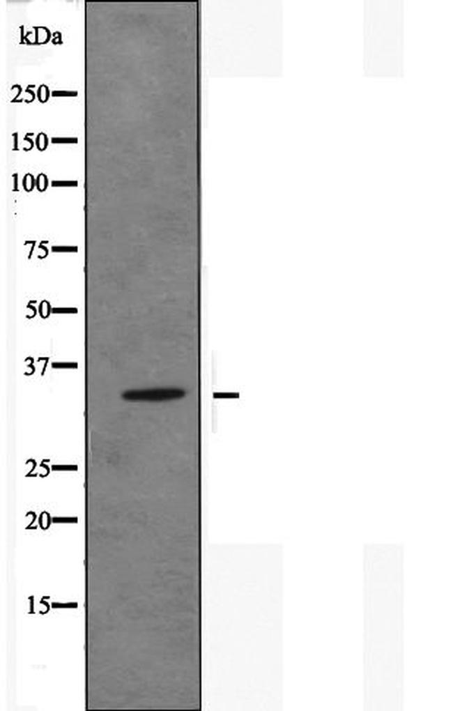 OR51E1 Antibody in Western Blot (WB)