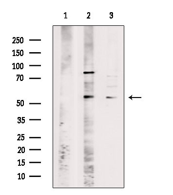 OR51I2 Antibody in Western Blot (WB)