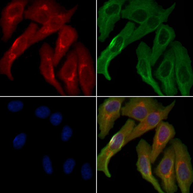 OR52E1 Antibody in Immunocytochemistry (ICC/IF)