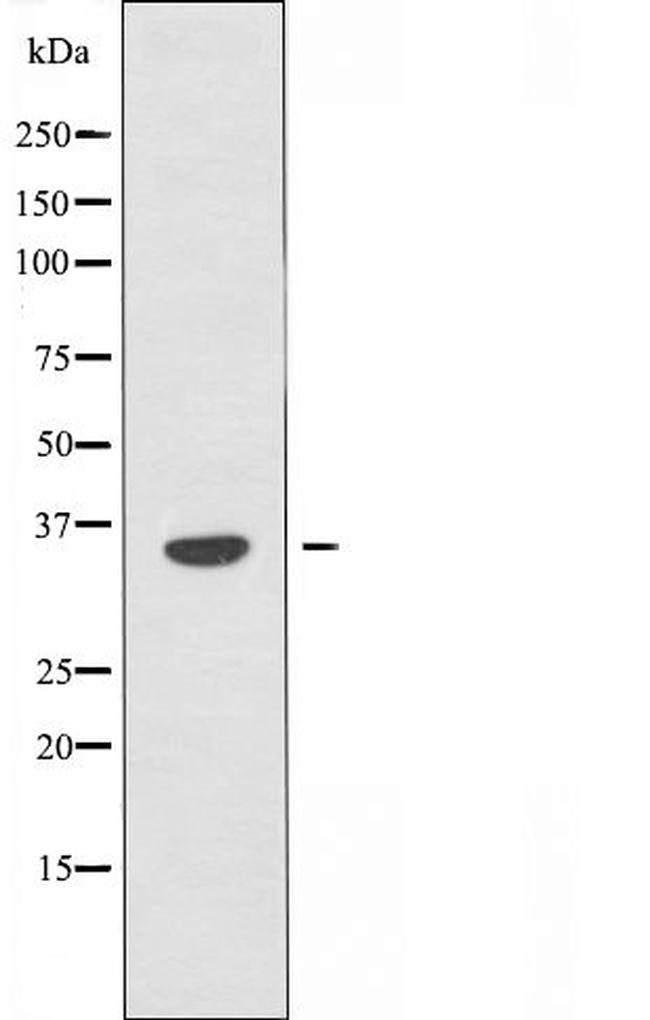 OPRD1 Antibody in Western Blot (WB)