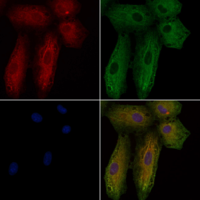 Rhodopsin Antibody in Immunocytochemistry (ICC/IF)