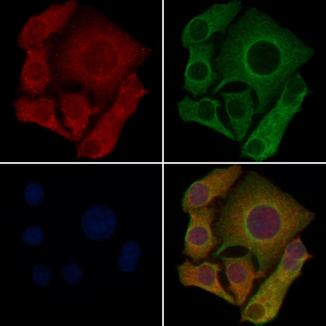 OR1B1 Antibody in Immunocytochemistry (ICC/IF)