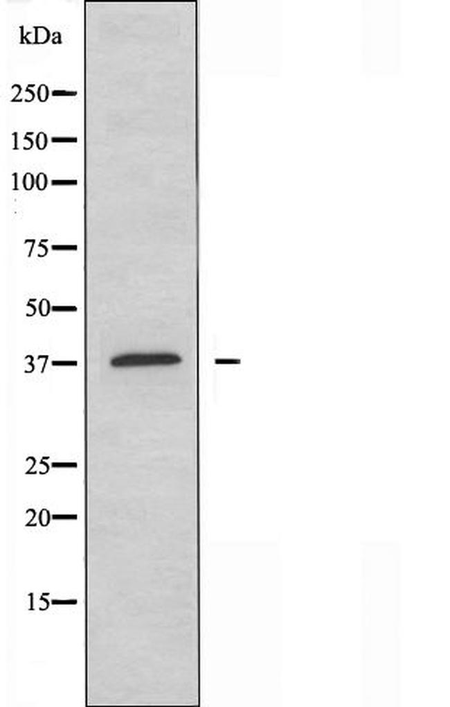 OR4A16 Antibody in Western Blot (WB)