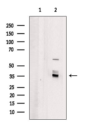 OR4X1 Antibody in Western Blot (WB)