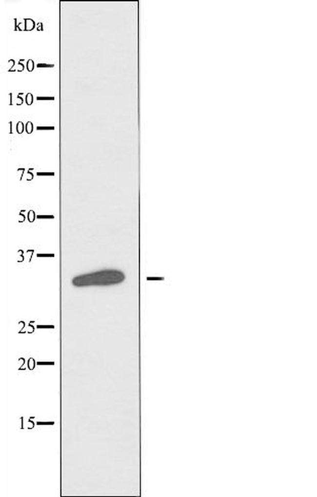 OR6P1 Antibody in Western Blot (WB)