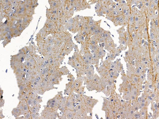 OR8S1 Antibody in Immunohistochemistry (Paraffin) (IHC (P))