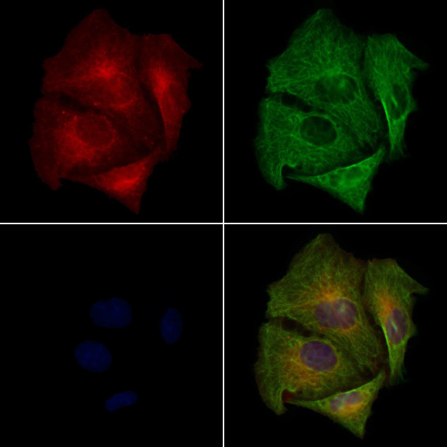 OR7E5P Antibody in Immunocytochemistry (ICC/IF)