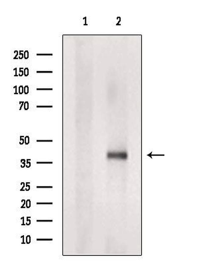 TMEM185A Antibody in Western Blot (WB)