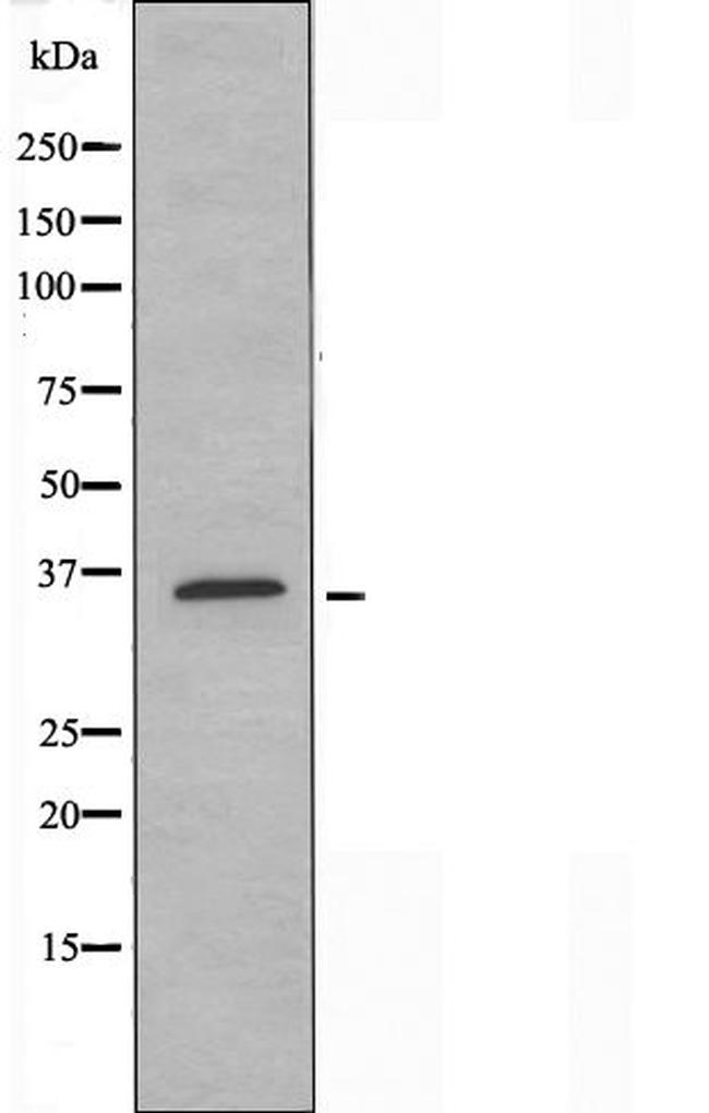TAS2R39 Antibody in Western Blot (WB)