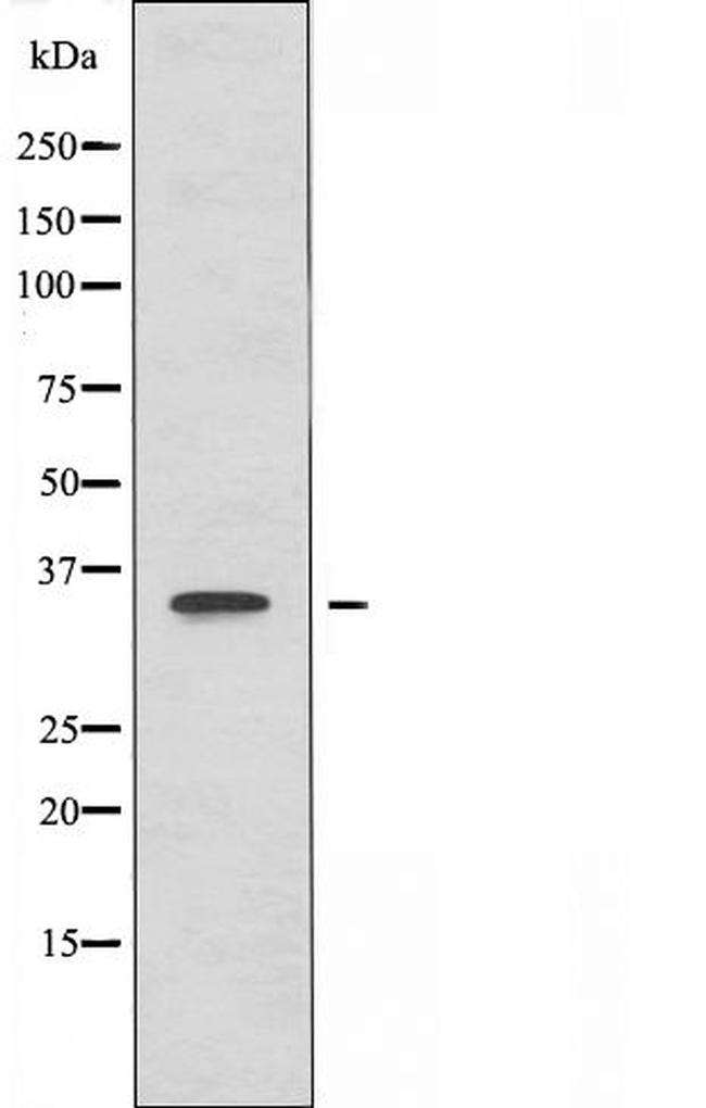 OR51B6 Antibody in Western Blot (WB)