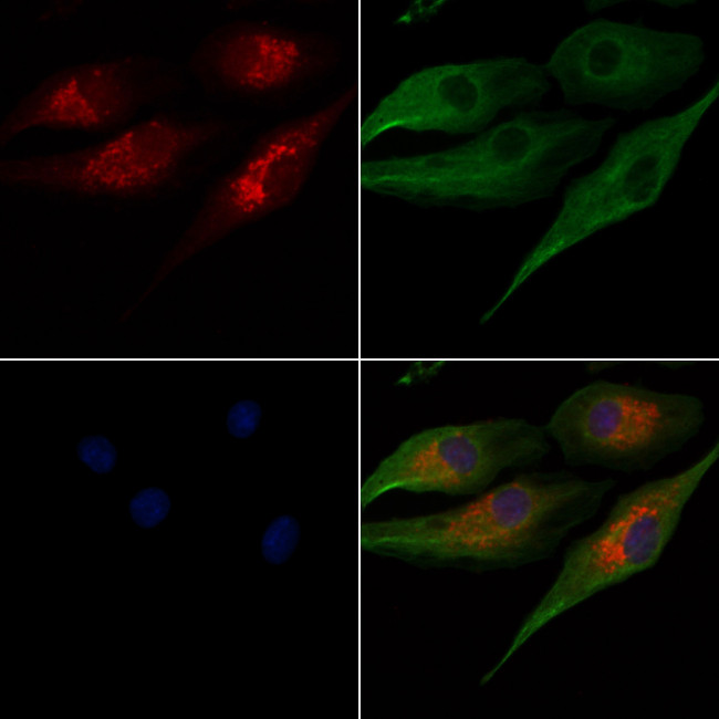 OR52E5 Antibody in Immunocytochemistry (ICC/IF)