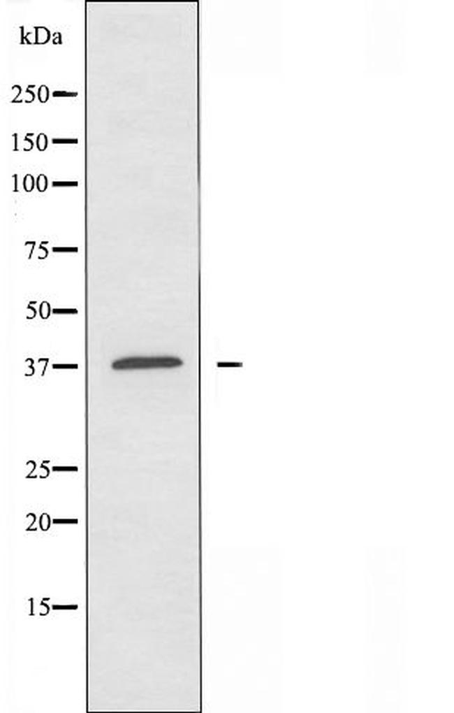 OR10H3/OR10H4 Antibody in Western Blot (WB)