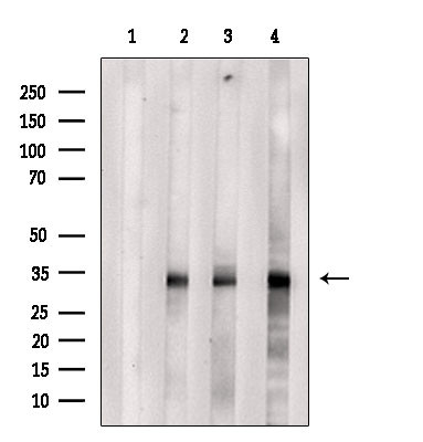 OR51B2 Antibody in Western Blot (WB)