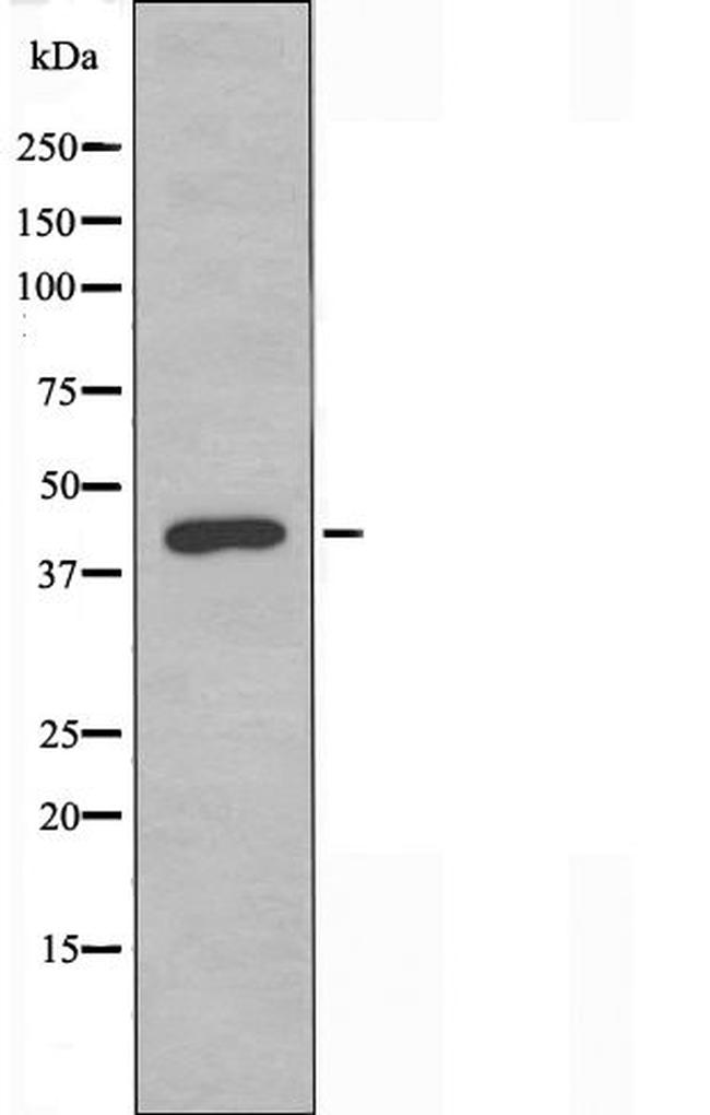 Protease-Activated Receptor-4 Antibody in Western Blot (WB)