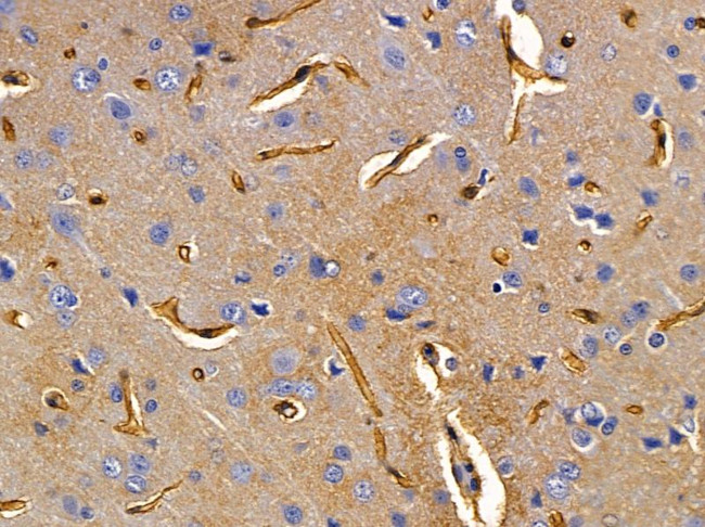 U12 Antibody in Immunohistochemistry (Paraffin) (IHC (P))