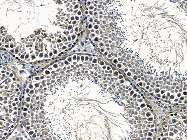 Cytomegalovirus US28 Antibody in Immunohistochemistry (Paraffin) (IHC (P))