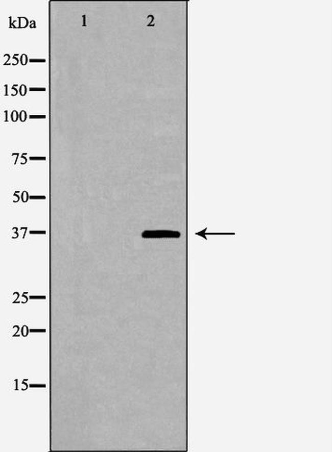 DOK4 Antibody in Western Blot (WB)