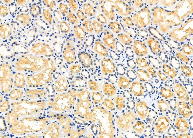 MTM1 Antibody in Immunohistochemistry (Paraffin) (IHC (P))