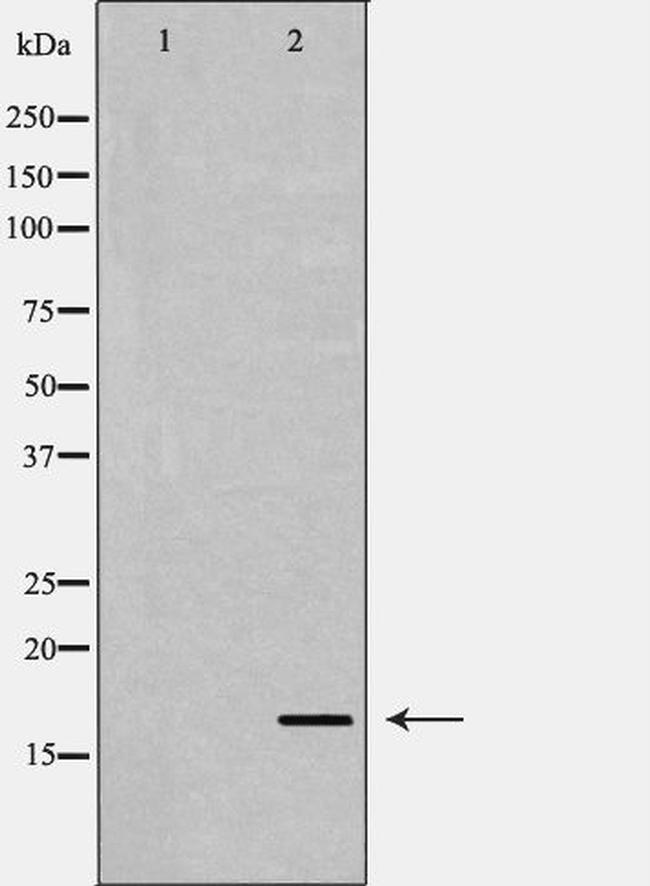 TGF alpha Antibody in Western Blot (WB)