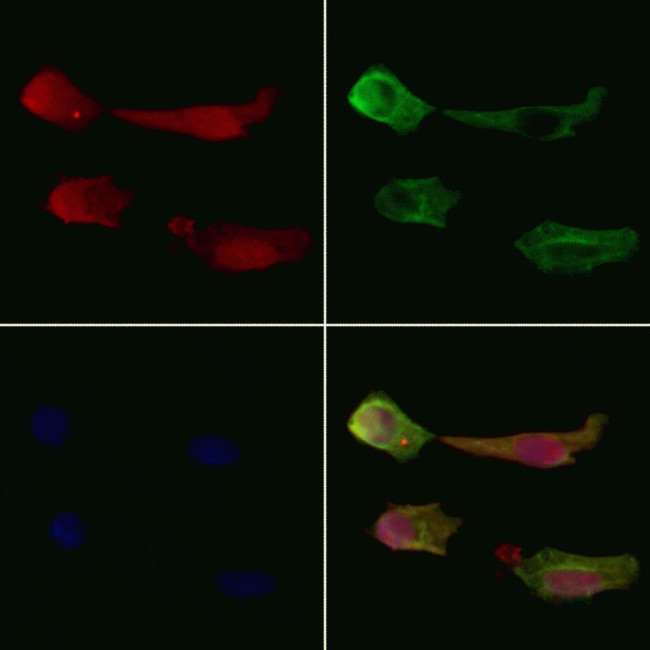 CDCA8 Antibody in Immunocytochemistry (ICC/IF)