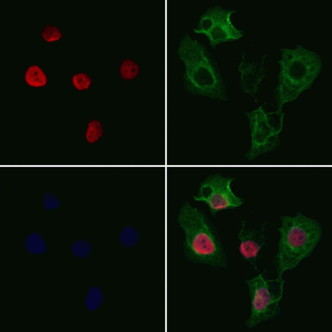 SMNDC1 Antibody in Immunocytochemistry (ICC/IF)