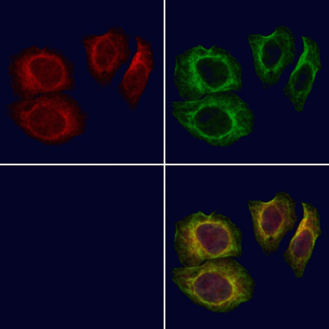 TCTN3 Antibody in Immunocytochemistry (ICC/IF)