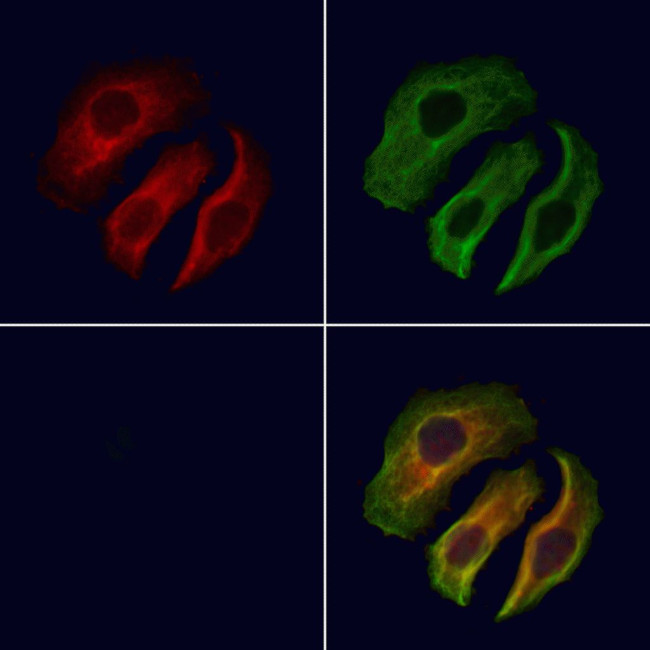 PRKAR1A Antibody in Immunocytochemistry (ICC/IF)