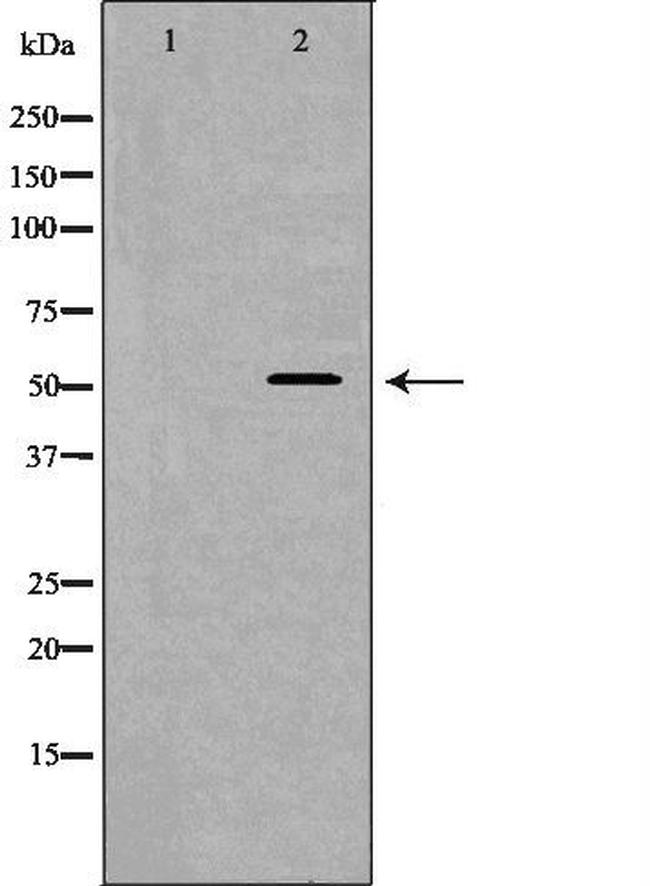 WASP Antibody in Western Blot (WB)