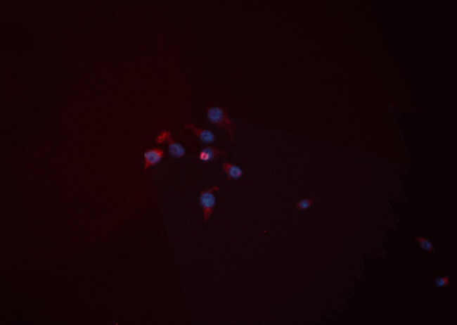 HK2 Antibody in Immunocytochemistry (ICC/IF)
