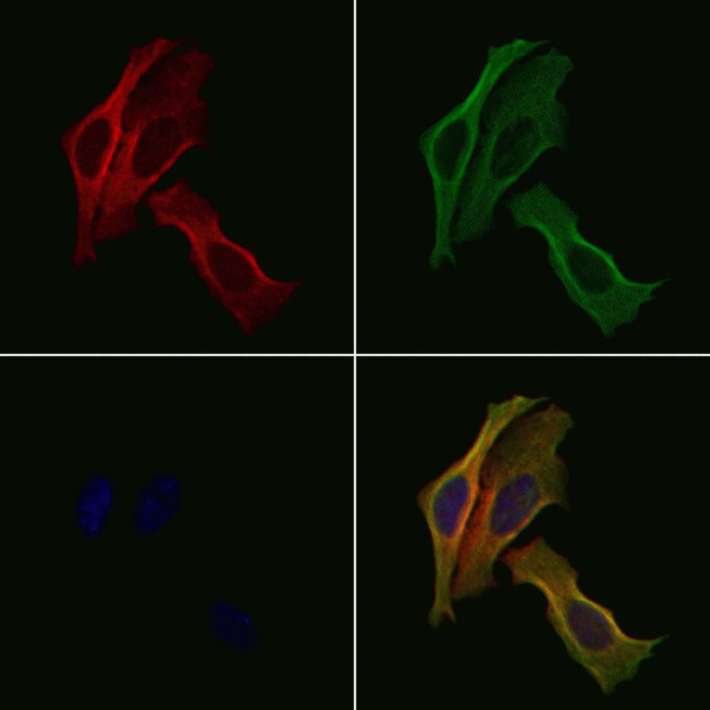 NCK1 Antibody in Immunocytochemistry (ICC/IF)