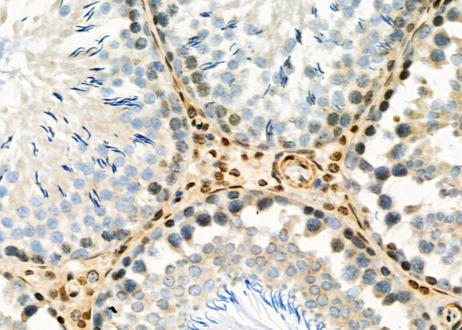 PSMB1 Antibody in Immunohistochemistry (Paraffin) (IHC (P))