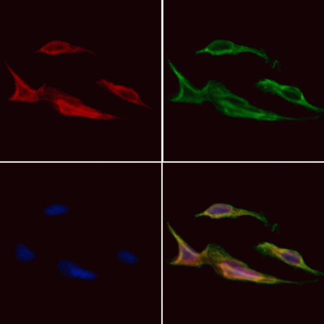 ARPC1A Antibody in Immunocytochemistry (ICC/IF)