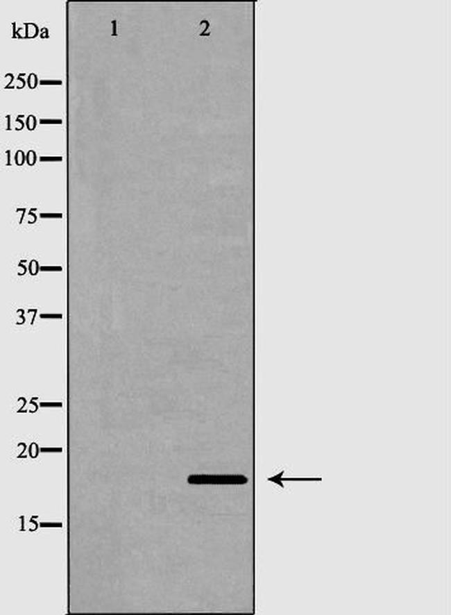 RNASE13 Antibody in Western Blot (WB)