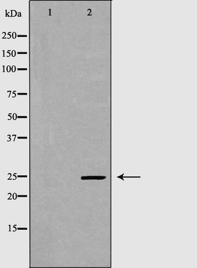 GPX5 Antibody in Western Blot (WB)