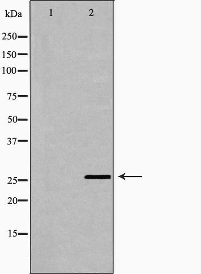 FAM3B Antibody in Western Blot (WB)