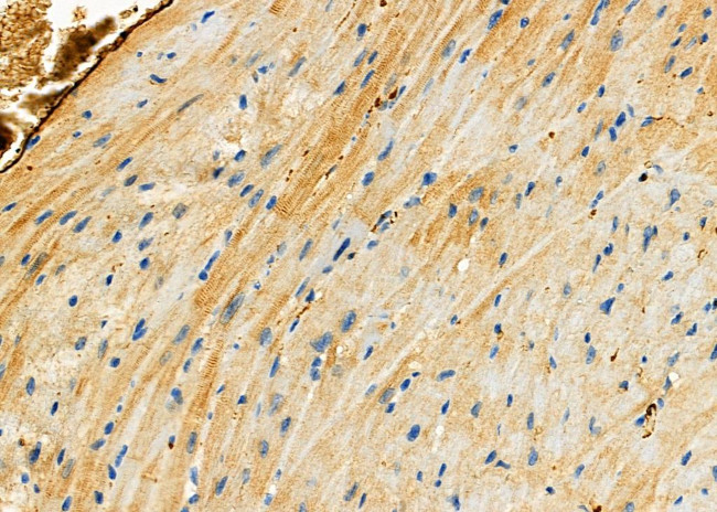 HIP2 Antibody in Immunohistochemistry (Paraffin) (IHC (P))