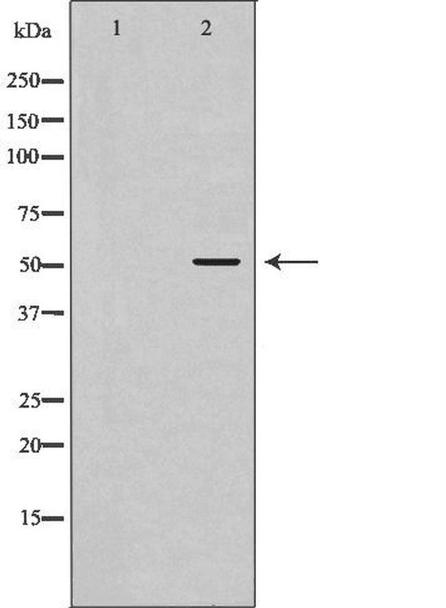 ATG4C Antibody in Western Blot (WB)